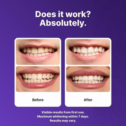 Purple Teeth Whitening Strips